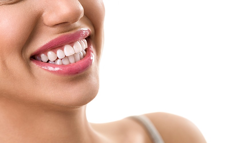 Porcelain Veneers at St. Andrews Dental