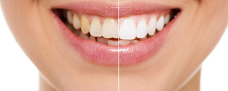 Cosmetic dentistry consultation at St. Andrews Dental.